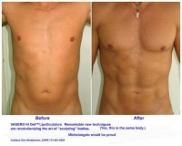 Cosmetic Surgery London 379911 Image 3